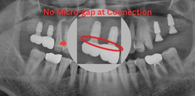 Interface micro-gap, photo 2