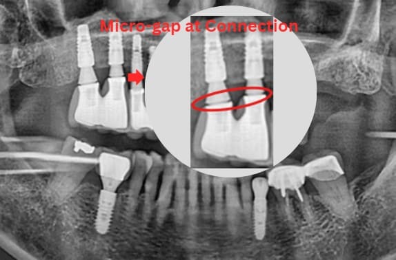 Interface micro-gap, photo 1